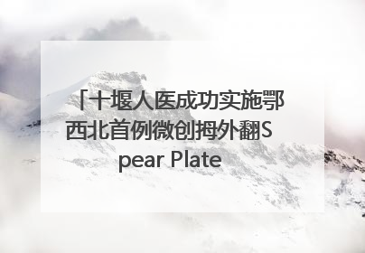 十堰人医成功实施鄂西北首例微创拇外翻Spear Plate髓内板矫形术